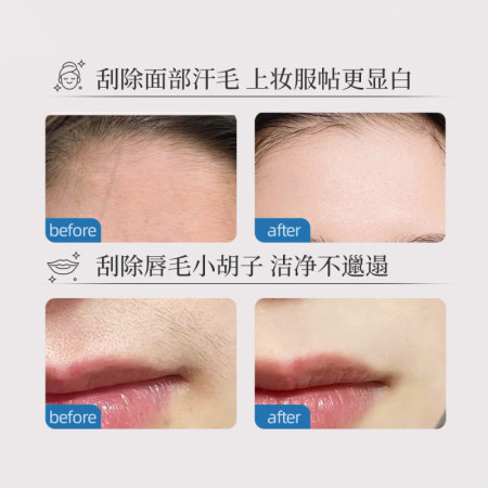 Painless Facial Hair Remover & Epilator – Spring Roller