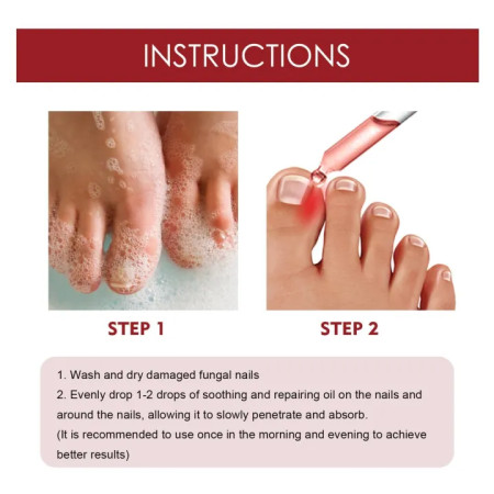 Anti Paronychia Relief Oil